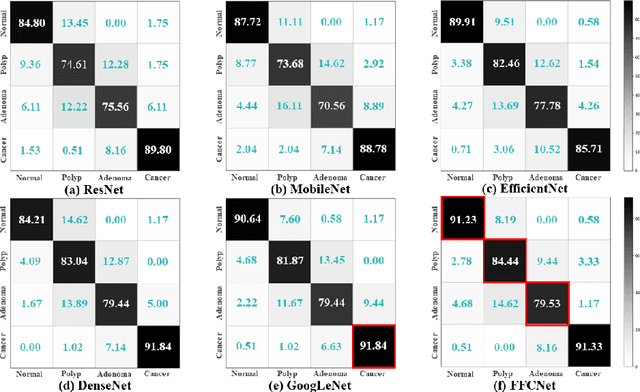 Figure 4 for FFCNet: Fourier Transform-Based Frequency Learning and Complex Convolutional Network for Colon Disease Classification