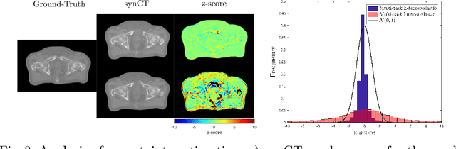 Figure 4 for Uncertainty in multitask learning: joint representations for probabilistic MR-only radiotherapy planning