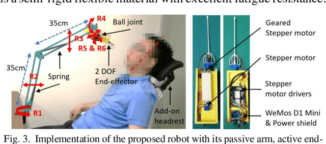 Figure 3 for Design of a Low-cost Miniature Robot to Assist the COVID-19 Nasopharyngeal Swab Sampling