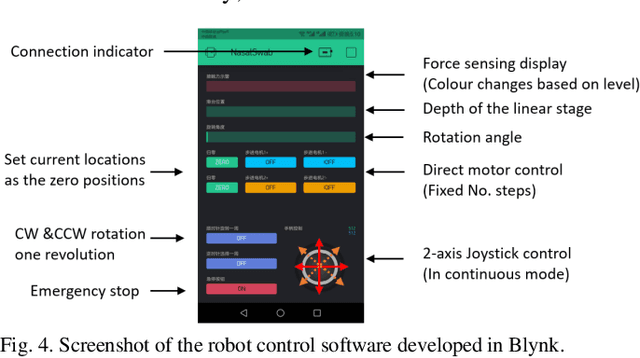 Figure 4 for Design of a Low-cost Miniature Robot to Assist the COVID-19 Nasopharyngeal Swab Sampling