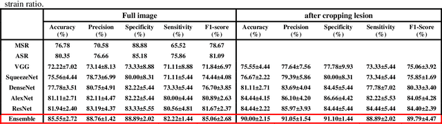 Figure 4 for Ensemble Transfer Learning of Elastography and B-mode Breast Ultrasound Images