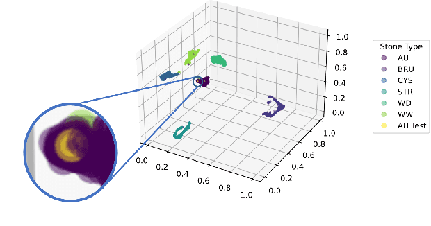 Figure 4 for Interpretable Deep Learning Classifier by Detection of Prototypical Parts on Kidney Stones Images