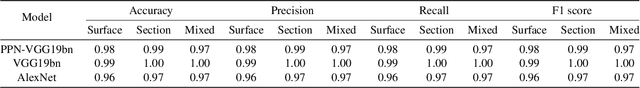 Figure 2 for Interpretable Deep Learning Classifier by Detection of Prototypical Parts on Kidney Stones Images