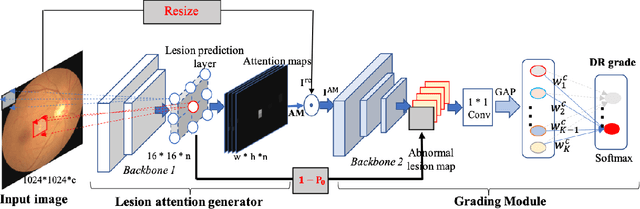 Figure 2 for Robust Collaborative Learning of Patch-level and Image-level Annotations for Diabetic Retinopathy Grading from Fundus Image
