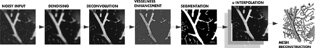 Figure 4 for Deep Learning Convolutional Networks for Multiphoton Microscopy Vasculature Segmentation