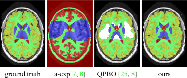 Figure 3 for Efficient optimization for Hierarchically-structured Interacting Segments (HINTS)