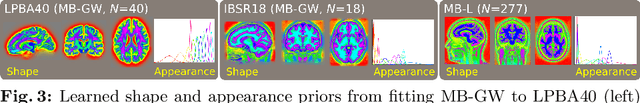 Figure 3 for Flexible Bayesian Modelling for Nonlinear Image Registration