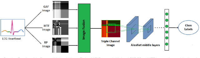 Figure 1 for ECG Heartbeat Classification Using Multimodal Fusion