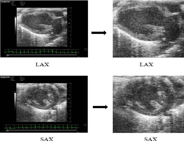 Figure 4 for Higher Order Dynamic Mode Decomposition: from Fluid Dynamics to Heart Disease Analysis