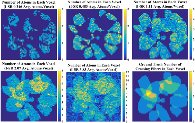 Figure 4 for Joint Spatial-Angular Sparse Coding for dMRI with Separable Dictionaries