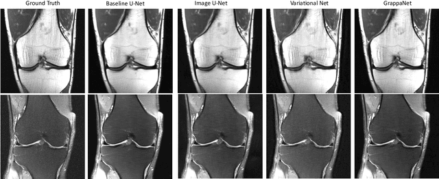 Figure 4 for GrappaNet: Combining Parallel Imaging with Deep Learning for Multi-Coil MRI Reconstruction