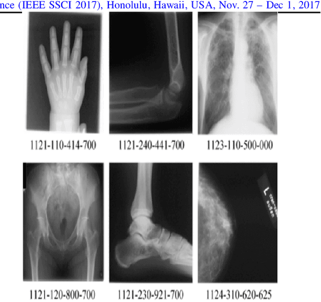 Figure 3 for Combining Real-Valued and Binary Gabor-Radon Features for Classification and Search in Medical Imaging Archives