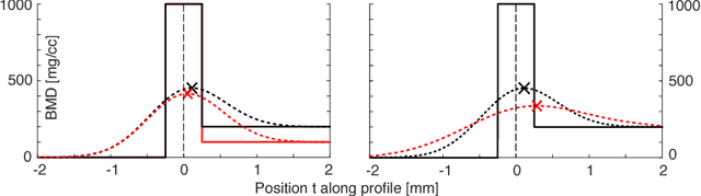 Figure 1 for An Analysis by Synthesis Approach for Automatic Vertebral Shape Identification in Clinical QCT