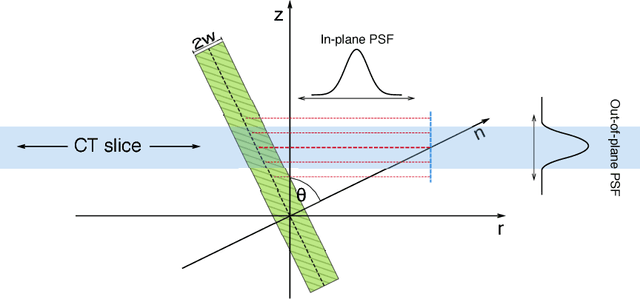 Figure 4 for An Analysis by Synthesis Approach for Automatic Vertebral Shape Identification in Clinical QCT