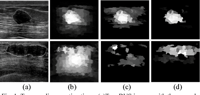 Figure 1 for A Hybrid Framework for Tumor Saliency Estimation