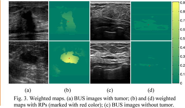 Figure 4 for A Hybrid Framework for Tumor Saliency Estimation