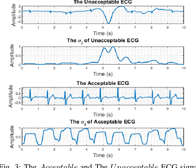 Figure 3 for Energy-Efficient Real-Time Heart Monitoring on Edge-Fog-Cloud Internet-of-Medical-Things