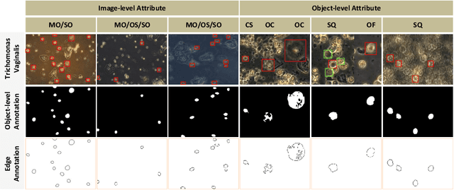 Figure 1 for Trichomonas Vaginalis Segmentation in Microscope Images