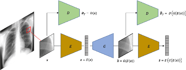 Figure 1 for Unsupervised Detection of Lung Nodules in Chest Radiography Using Generative Adversarial Networks