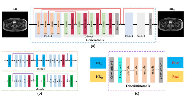Figure 1 for High-Resolution Pelvic MRI Reconstruction Using a Generative Adversarial Network with Attention and Cyclic Loss