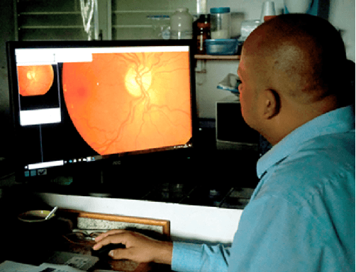 Figure 3 for Deep Learning based Computer-Aided Diagnosis Systems for Diabetic Retinopathy: A Survey