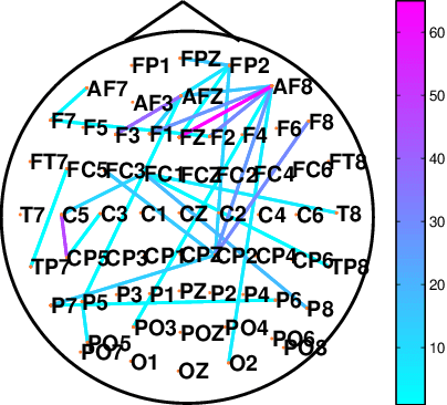 Figure 2 for Identification of Dynamic functional brain network states Through Tensor Decomposition