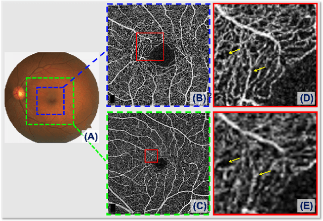 Figure 1 for Sparse-based Domain Adaptation Network for OCTA Image Super-Resolution Reconstruction