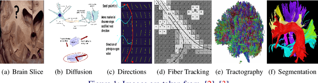 Figure 1 for BrainSegNet : A Segmentation Network for Human Brain Fiber Tractography Data into Anatomically Meaningful Clusters