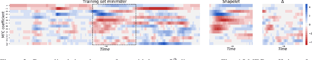 Figure 4 for Generalised Interpretable Shapelets for Irregular Time Series