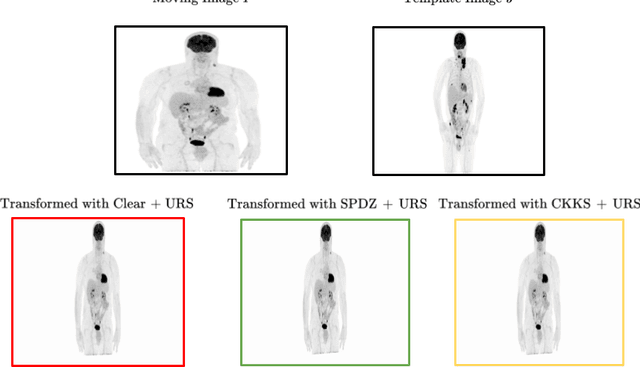 Figure 3 for Privacy Preserving Image Registration