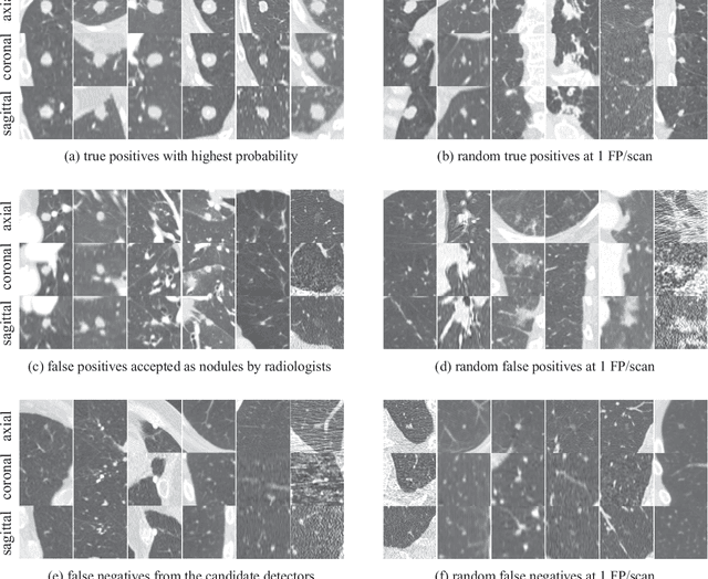 Figure 3 for Validation, comparison, and combination of algorithms for automatic detection of pulmonary nodules in computed tomography images: the LUNA16 challenge