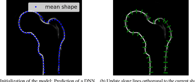 Figure 3 for Deep Morphing: Detecting bone structures in fluoroscopic X-ray images with prior knowledge