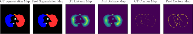 Figure 3 for Shape-Aware Complementary-Task Learning for Multi-Organ Segmentation