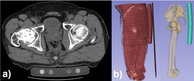 Figure 2 for Automated segmentation of an intensity calibration phantom in clinical CT images using a convolutional neural network