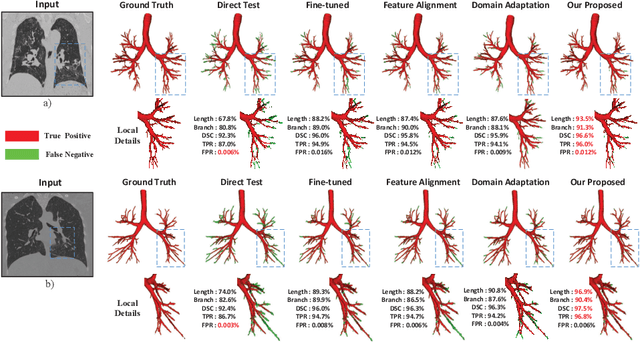 Figure 4 for FDA: Feature Decomposition and Aggregation for Robust Airway Segmentation