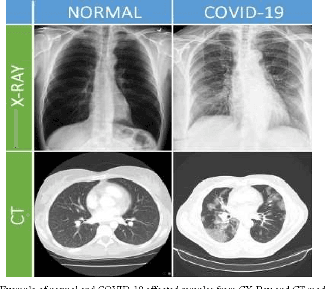 Figure 1 for A Survey of Deep Learning Techniques for the Analysis of COVID-19 and their usability for Detecting Omicron