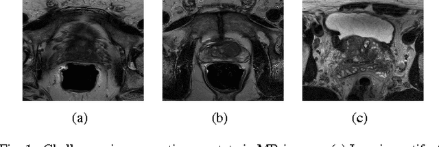 Figure 1 for Deeply-Supervised CNN for Prostate Segmentation