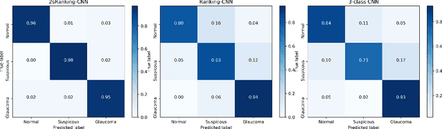 Figure 4 for 2sRanking-CNN: A 2-stage ranking-CNN for diagnosis of glaucoma from fundus images using CAM-extracted ROI as an intermediate input