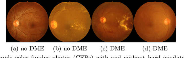 Figure 2 for Scientific Discovery by Generating Counterfactuals using Image Translation