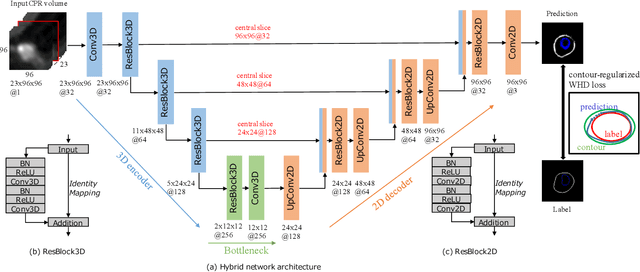Figure 1 for Coronary Wall Segmentation in CCTA Scans via a Hybrid Net with Contours Regularization