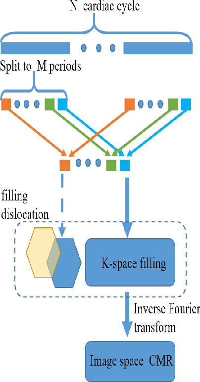 Figure 2 for CMR motion artifact correction using generative adversarial nets