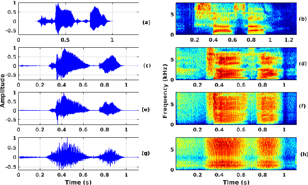 Figure 1 for Processing Phoneme Specific Segments for Cleft Lip and Palate Speech Enhancement