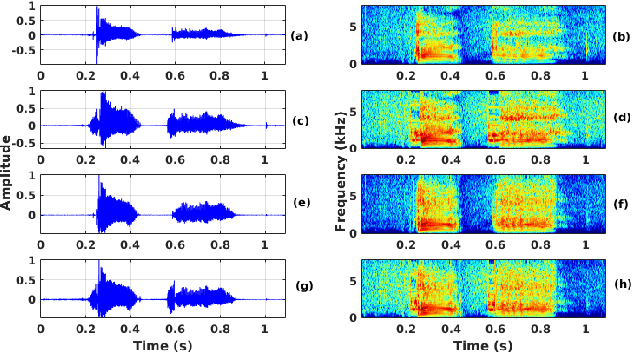 Figure 3 for Processing Phoneme Specific Segments for Cleft Lip and Palate Speech Enhancement
