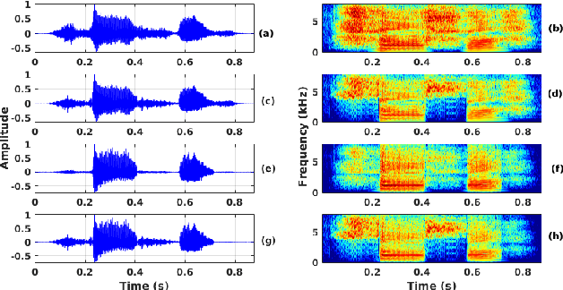 Figure 4 for Processing Phoneme Specific Segments for Cleft Lip and Palate Speech Enhancement
