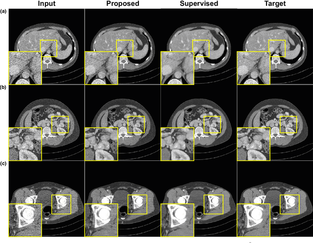 Figure 2 for Cycle Consistent Adversarial Denoising Network for Multiphase Coronary CT Angiography