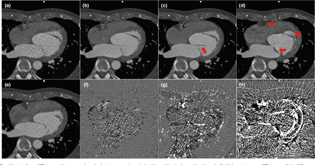 Figure 3 for Cycle Consistent Adversarial Denoising Network for Multiphase Coronary CT Angiography