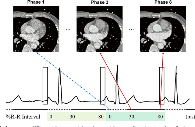 Figure 1 for Cycle Consistent Adversarial Denoising Network for Multiphase Coronary CT Angiography
