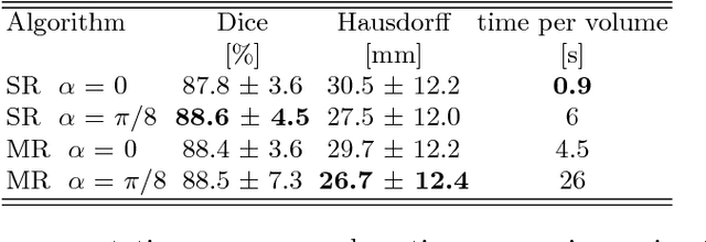 Figure 2 for Action Learning for 3D Point Cloud Based Organ Segmentation
