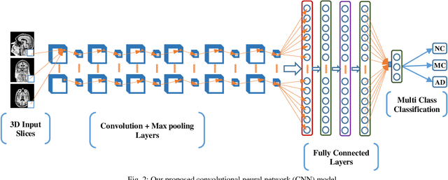Figure 2 for Deep Convolutional Neural Network based Classification of Alzheimer's Disease using MRI data