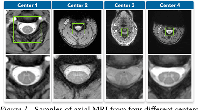 Figure 1 for Unsupervised domain adaptation for medical imaging segmentation with self-ensembling